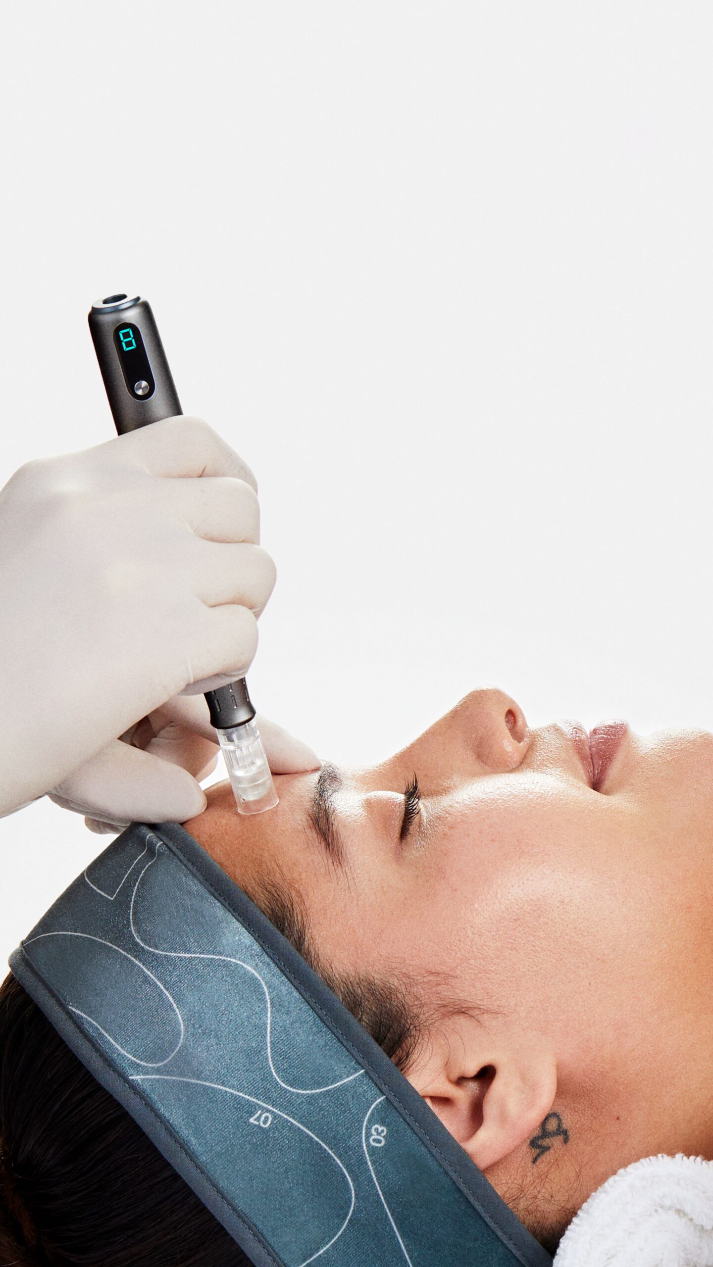 Microneedling-Behandlung mit Dermalogica Pro - Nahaufnahme eines innovativen Hautpflegegeräts, das auf die Stirn einer entspannten Kundin angewendet wird.